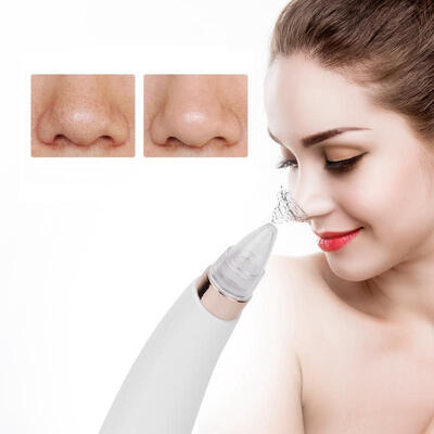 Greensen USB Charging Facial Ance Blackhead Pores Cleaner Vacuum Suction Peeling Care Beauty Device
Greensen USB Charging Facial Ance Blackhead Pores Cleaner Vacuum Suction Peeling Care Beauty Device