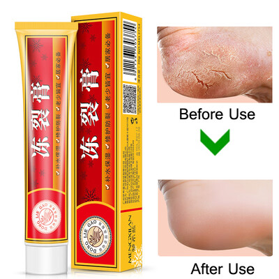 Powerful Hand Foot Crack Cream Heel Chapped Peeling Foot&Hand Repair Anti Chapping Wrinkle Treatment Skin Cracking
Powerful Hand Foot Crack Cream Heel Chapped Peeling Foot&Hand Repair Anti Chapping Wrinkle Treatment Skin Cracking