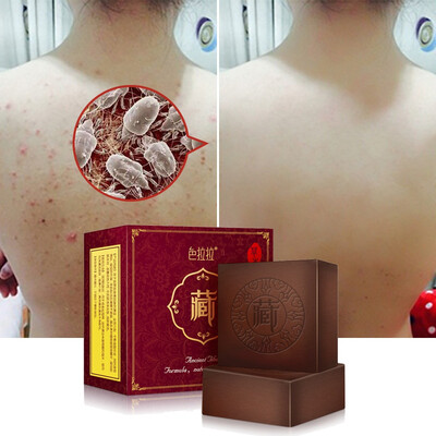 100g Natural Herbal Pimple Pores Blackhead Removal Treatment Oil Control Moisturizing Face Body Wash Soap
100g Natural Herbal Pimple Pores Blackhead Removal Treatment Oil Control Moisturizing Face Body Wash Soap