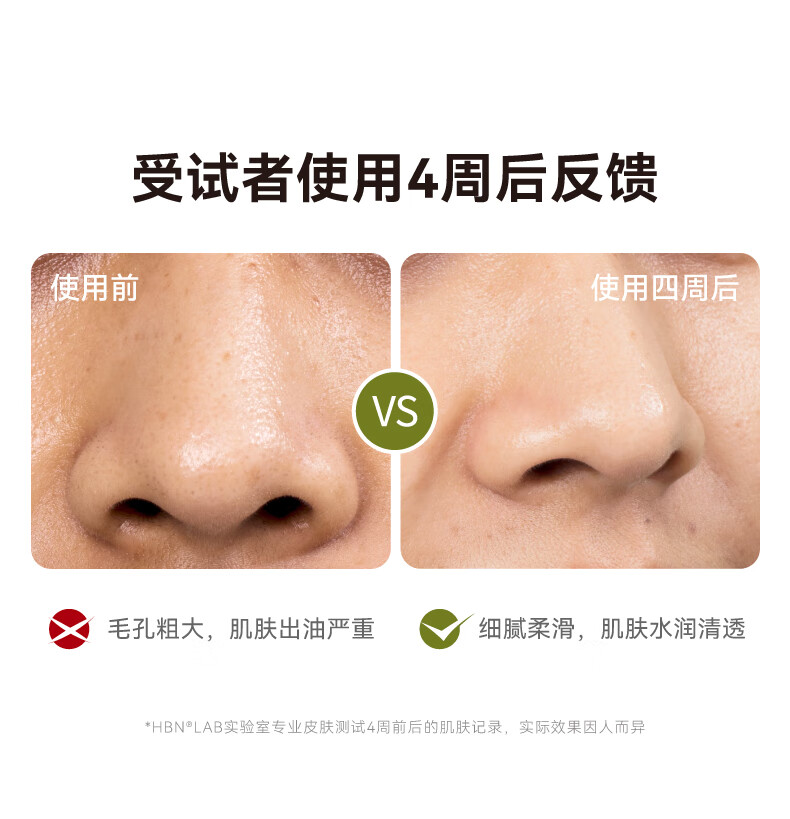 HBN护肤套装发光水视黄醇抗皱提拉紧致护肤品保湿皱纹 精萃水+洗面奶