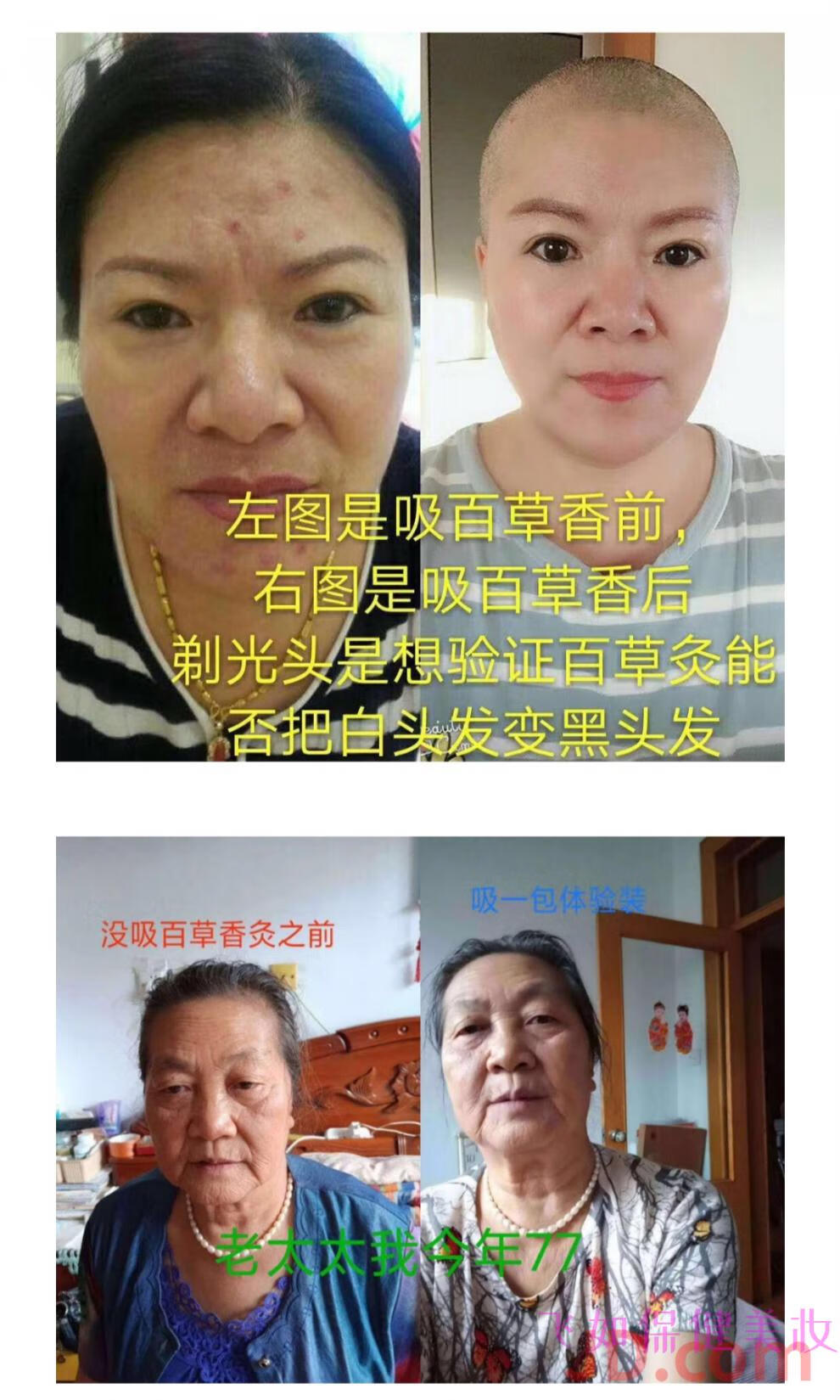 百草香灸百草香灸百草香灸烟馨百草官方正宗香艾香灸微商同款官方正宗
