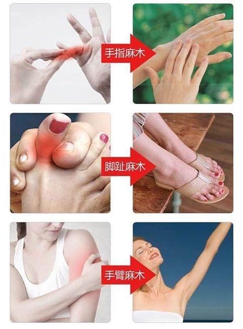 手脚麻木用一人好一人手足麻木贴手脚麻木酸胀沉重手麻脚麻肢体麻手麻