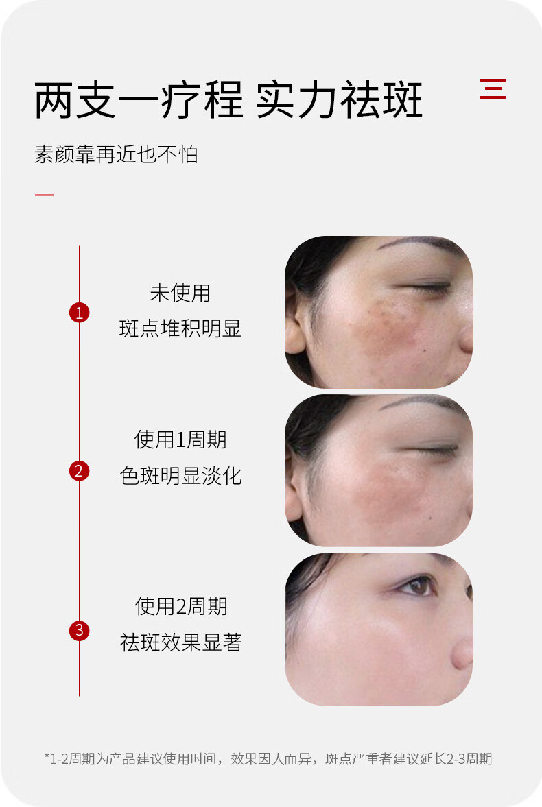 泊蝶（BEOTUA）肤研美白祛斑霜烟酰胺美白淡斑淡化斑色保湿润肤面霜正装产品男女 肤研美白祛斑霜20g（5支）