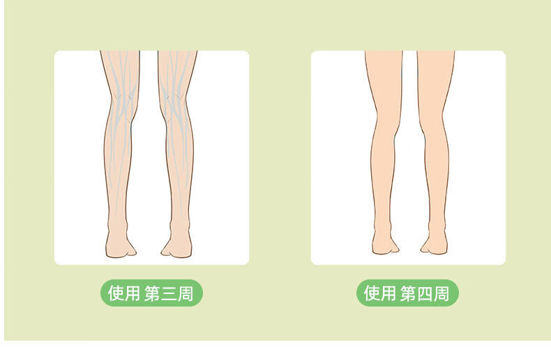 0kg店铺:舒坦弗医疗器械专营店商品编号:10048850081322商品名称:腿部