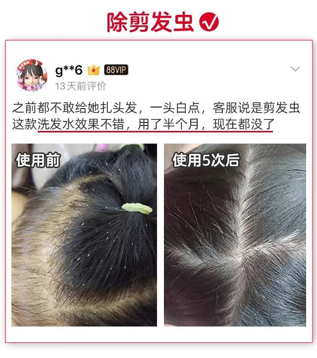 艾草洗发水剪发虫洗发水男女儿童专用卷发虫艾草去屑止痒除螨控油洗发