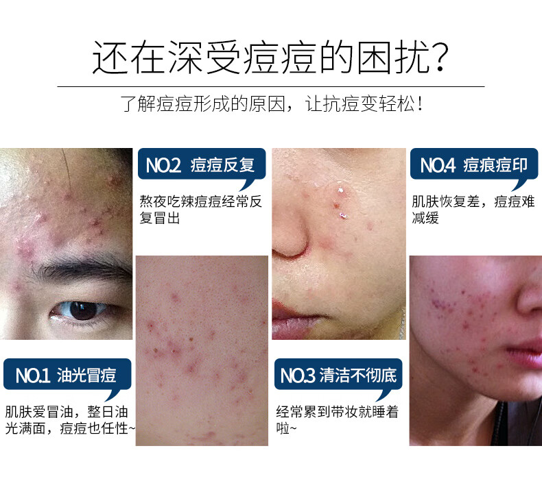 初中生小学生青春期6-12-18岁男孩护肤品套装青少年男生滋润肤露学生控油抑痘洗面奶艾芭薇乳液