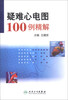 

疑难心电图100例精解