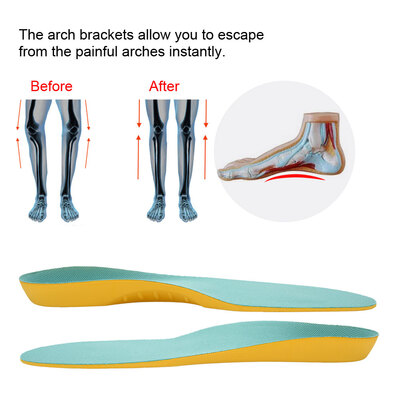 

5 Types Orthotic Corrective Arch Support Cushion Shoe Inserts Insoles Pads for Kids Orthotic Insoles Shoe Insoles