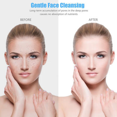 

Greensen USB Anion Import Instrument Face Beauty Machine Ultrasound Therapy Facial Skin Rejuvenation