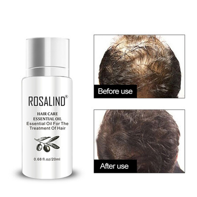 

20ml Keratin Treatment Hair Serum Hair Treatment Mask Keratin for Hair Nourish Scalp Repair Dry Damage Hair Care