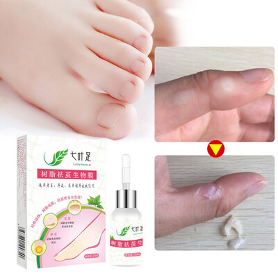 

Medicine Treatment Foot Plantar Warts Pomada De Verruga Foot Care Medical Plaster Ointment Removal Foot Care