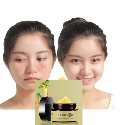 

Ginseng Acne Cream Natrual Removes Acne Hydrating Acne Cream Oil Control Nourish Facial Repair