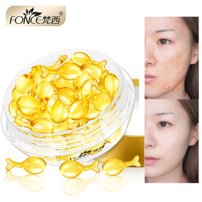 

Fonce Korea Capsule Facial Essence Acne Wrinkle Moisturizing Replenishing Water Whitening And Tender Skin Magic Water