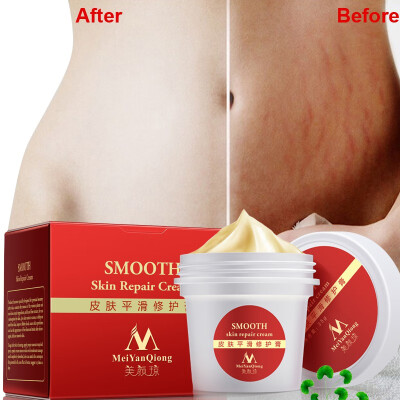 

Smooth Skin Cream For Stretch Marks Scar Removal To Maternity Skin Repair Body Cream Remove Scar Care
