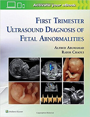 

First Trimester Ultrasound Diagnosis of Fetal Ab