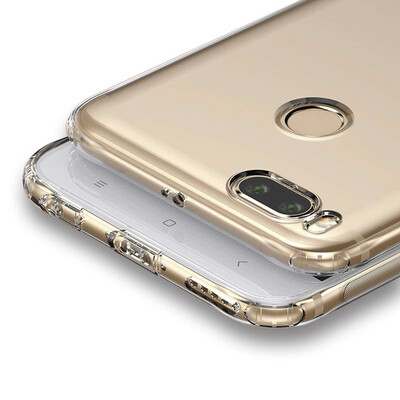 

Вали (VALEA) MI 5X Mobile Shell / Cover