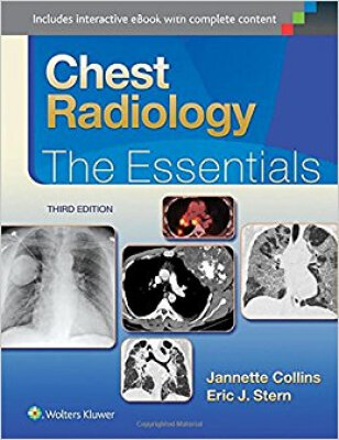 

Chest Radiology The Essentials Essentials Seri