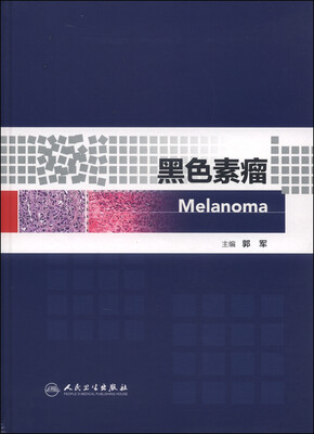 

黑色素瘤[Melanoma