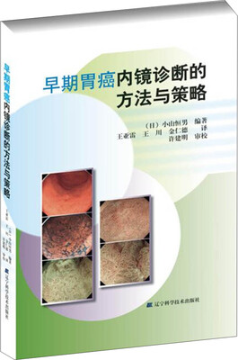 

早期胃癌内镜诊断的方法与策略