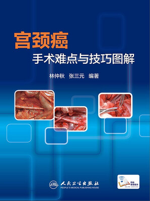 

宫颈癌手术难点与技巧图解
