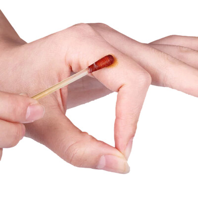 

Merlot Merope iodine cotton swabs alcohol cotton swabs disinfectant sterilization nursing cotton swabs alcohol cotton swab mixed with 50 of 100