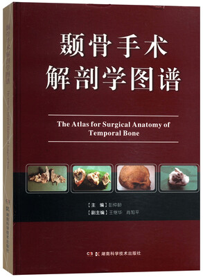 

颞骨手术解剖学图谱
