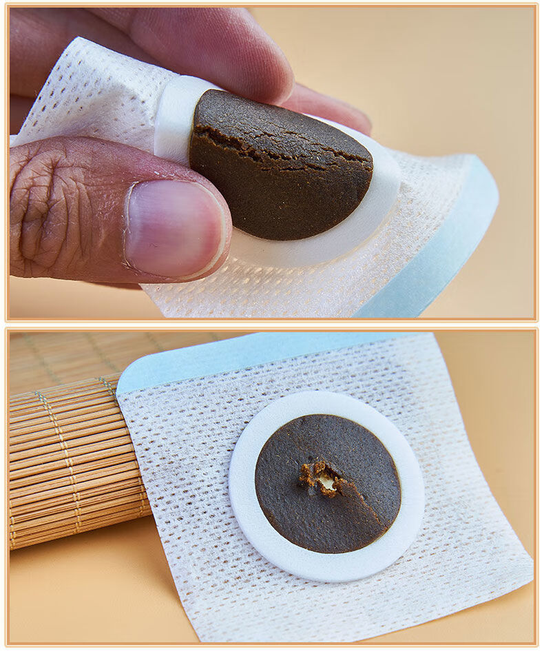 药店直售 宝宝胀气贴肠绞痛肠胀气神器婴儿肚子肚脐贴新生儿用品排气