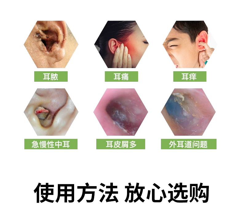 维真园 4%硼酸酒精抑菌液 成人儿童耳朵痒肿痛 真菌感染 油耳清洁液