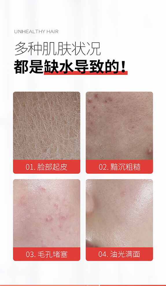 白云山【官方直售店】白云山烟酰胺马来西亚甘油液护肤提亮保湿暗沉旗舰 1瓶强效款【臻羞%15烟酰胺】120ml