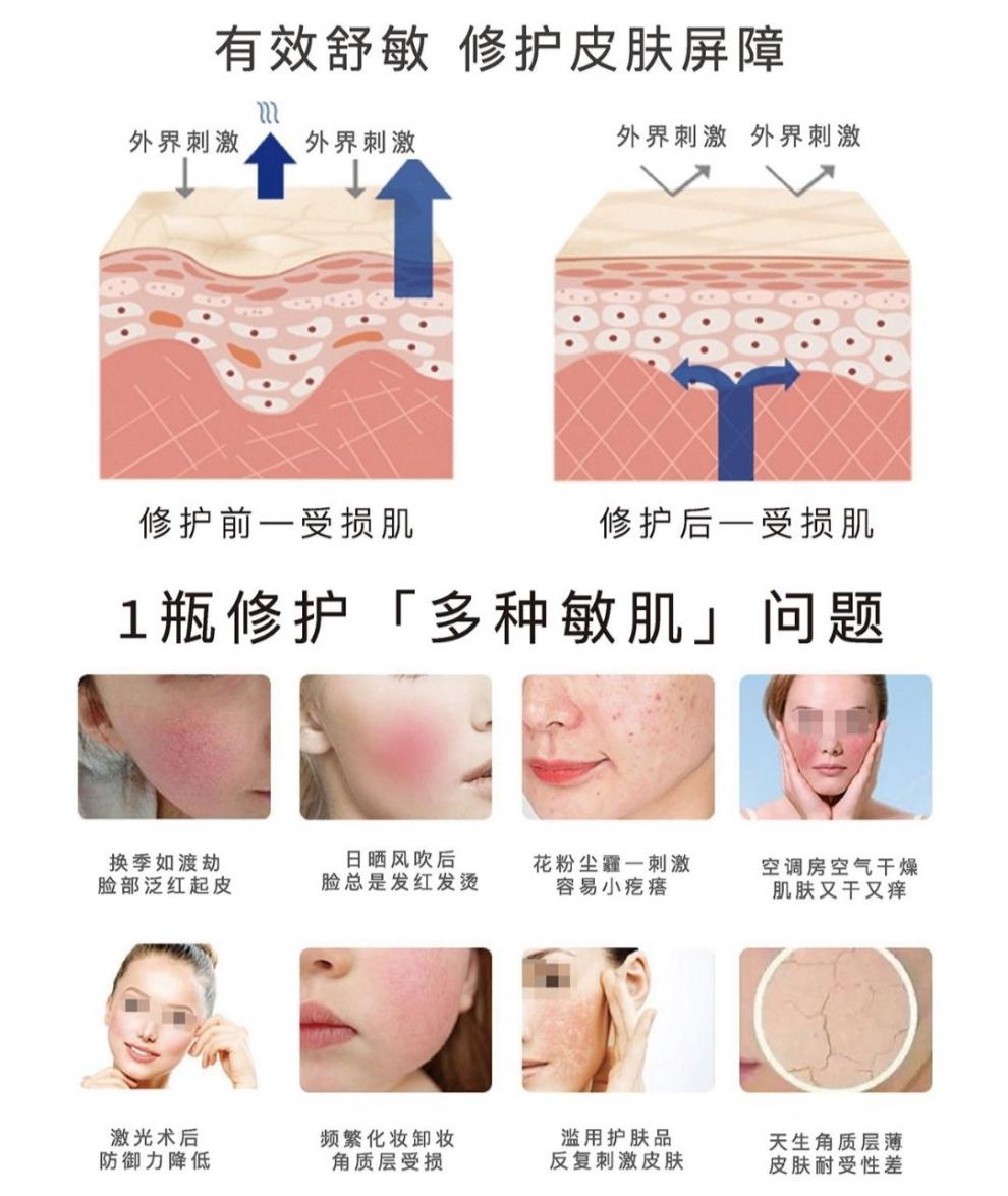 深圳翌芙莱一品莲多肽深层修护乳30克防伪滋养舒缓修复 深圳翌芙莱一品莲多肽深层修护乳30克防伪后滋养舒缓