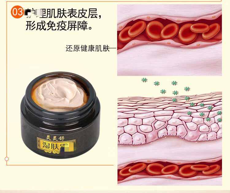 官方旗舰灵灵舒湿肤霜私处止痒霜男女肛门肛周大腿内侧湿痒皮肤湿痒霜