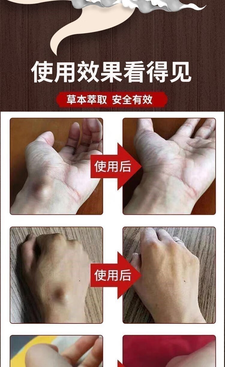 伊夏 万立芙腱鞘膏红言五号红言5号网众柯瑞森一号网众雪云柯瑞森一号