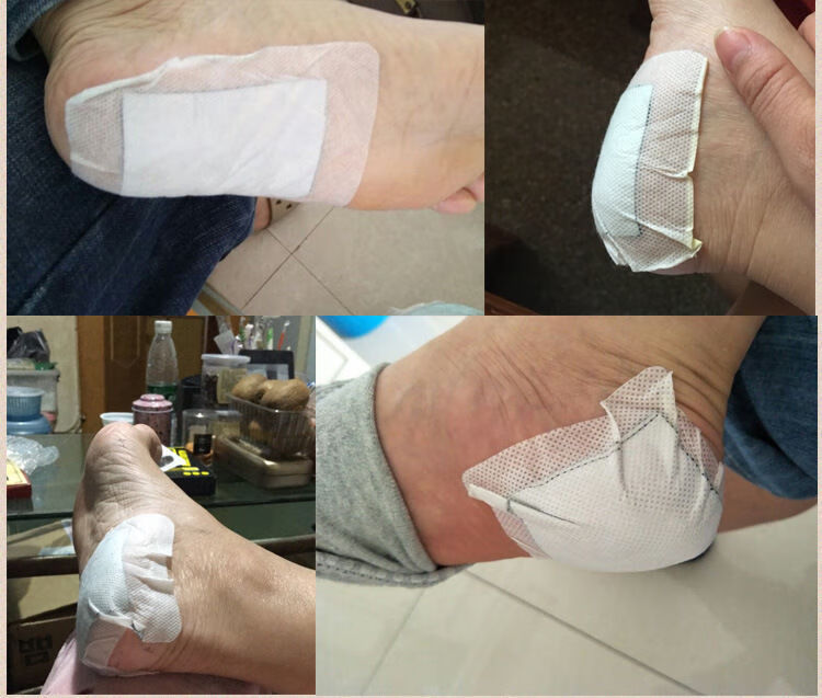 足跟痛贴脚后跟疼痛药贴产后足跟止痛贴足跟骨刺足底筋膜炎跟腱炎