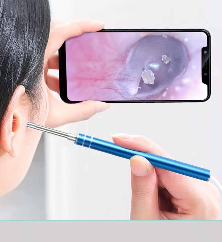 米家生态链通用可视采耳仪器高清掏耳勺内窥镜耳内镜高清挖耳勺智能掏