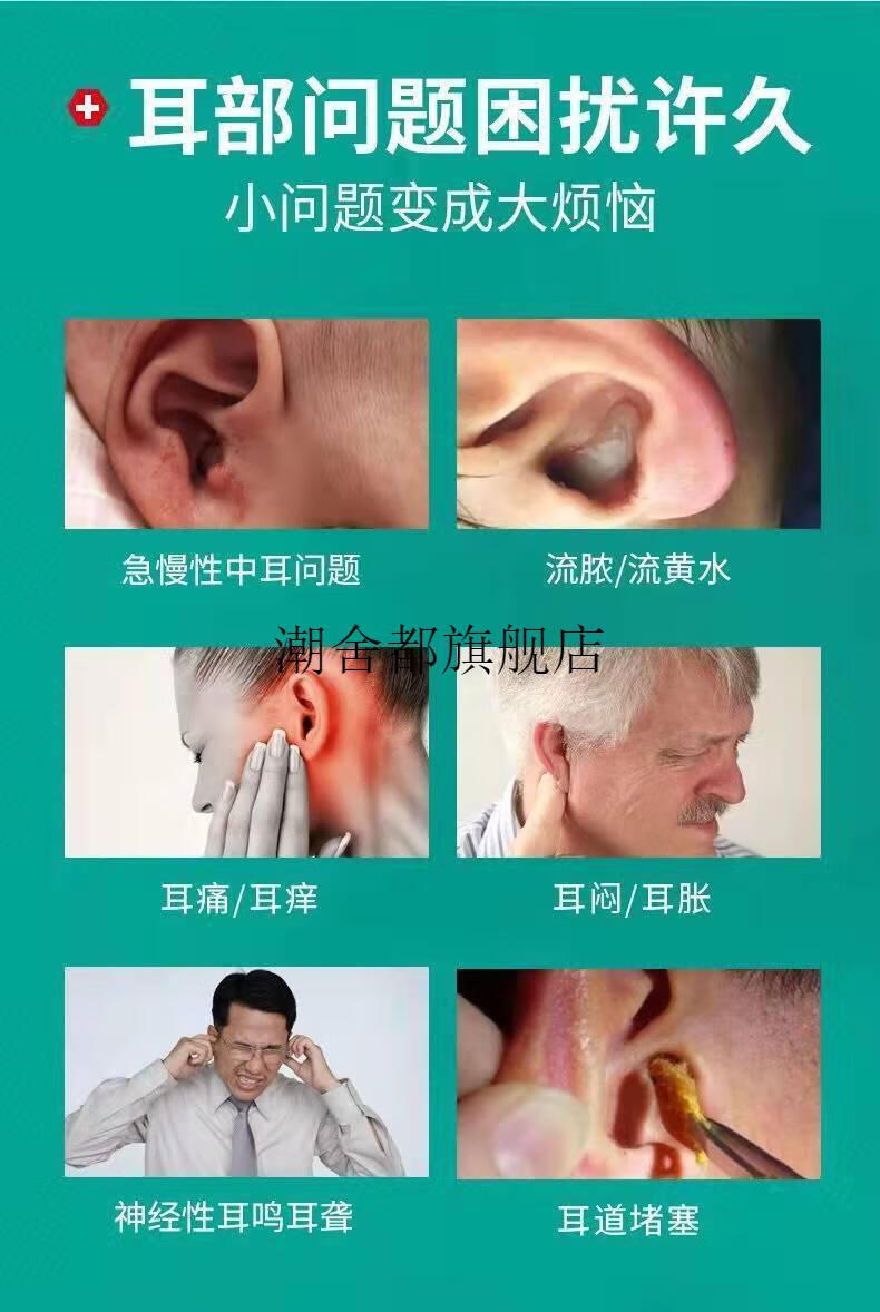 硼酸酒精滴耳液4硼酸酒精中耳炎滴耳液人用中耳流脓止痒耳膜炎耳朵