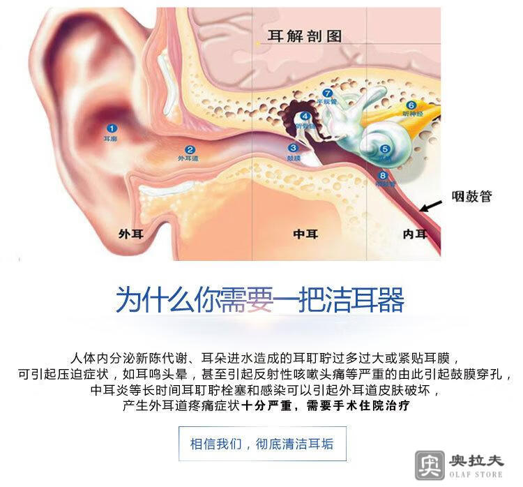 电动掏耳朵神器吸耳屎掏耳挖耳勺清洁器扣油性可视掏耳屎挖全自动