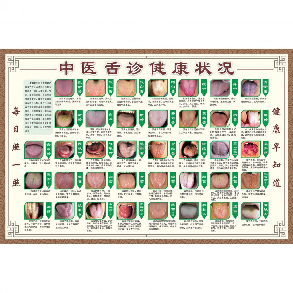舌诊健康状况对照表图解医院挂图中医经络养生馆舌苔问题海报墙贴人体