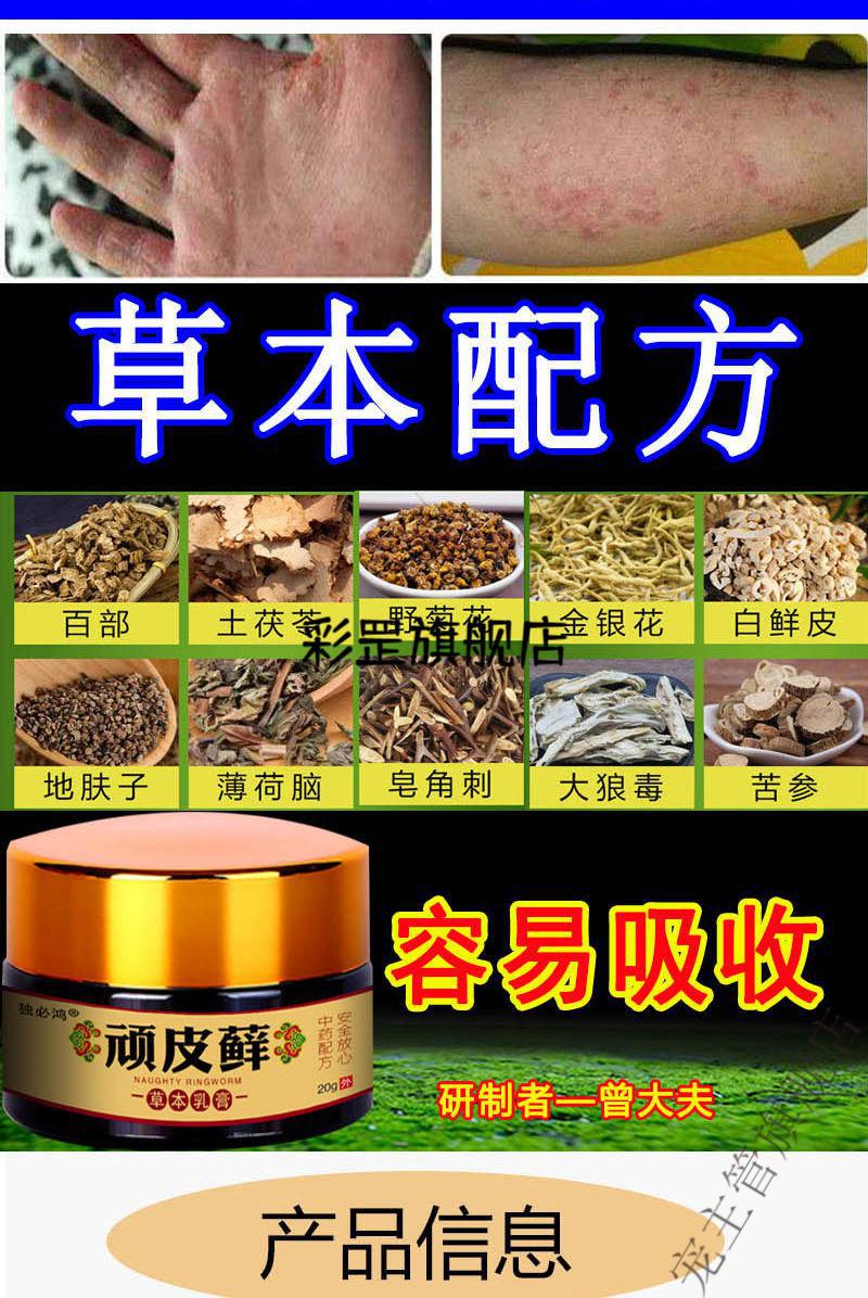 复方黄柏祛l癣搽剂治l疗牛l皮l癣银l屑l病瘙痒止l痒湿l疹去l根体l股l