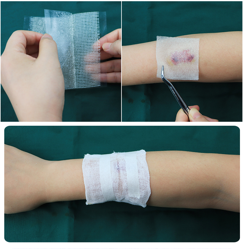 鱼跃(yuwell)同款医用凡士林纱布无菌纱布块油纱布伤口敷料黄纱布防止