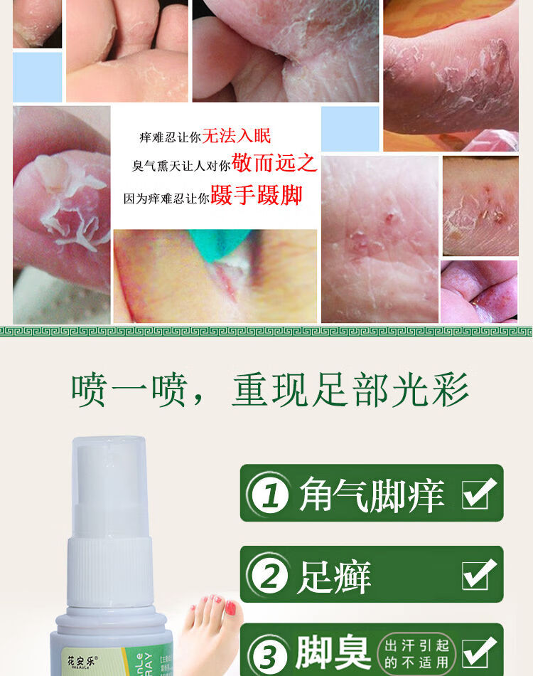 旗舰店花安乐喷剂去止痒灰指甲佳和足舒美4盒装