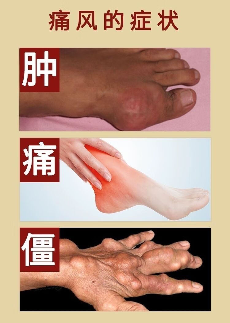 加丹7号风痛喷剂风痛克星一盒装轻度缓解症状