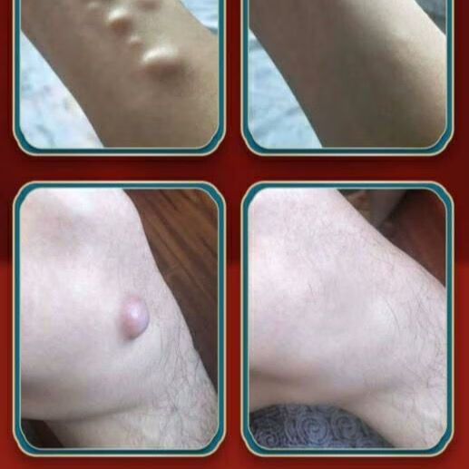 林芙堂脂肪贴延安苏季善效帖林芙堂消脂贴绿盒苏延安苏季善效季善效苏