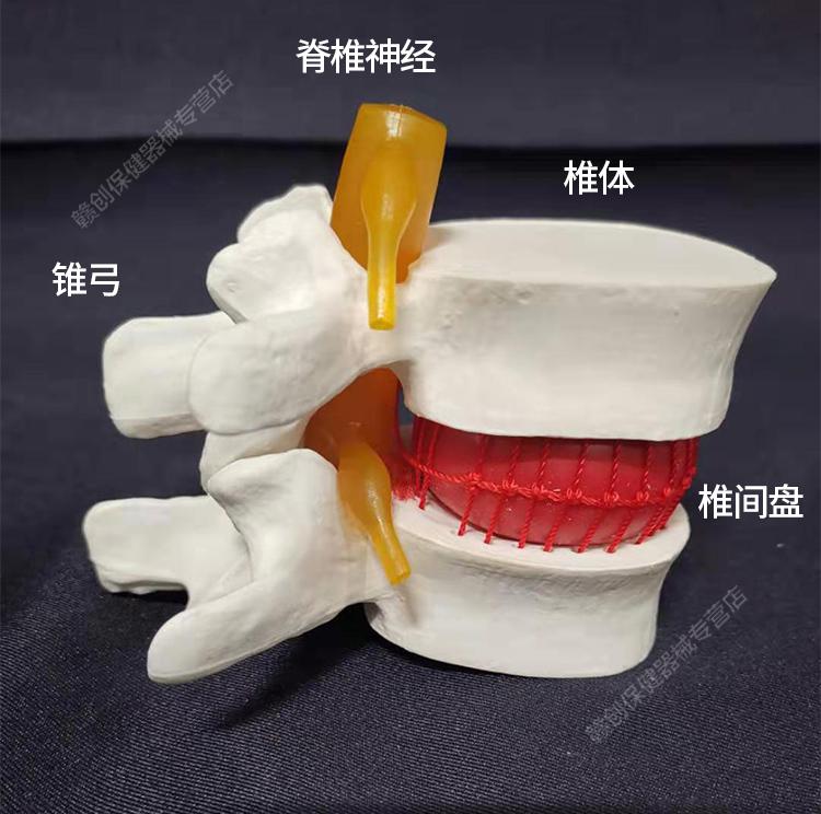 腰椎1一5截图高清模型图片