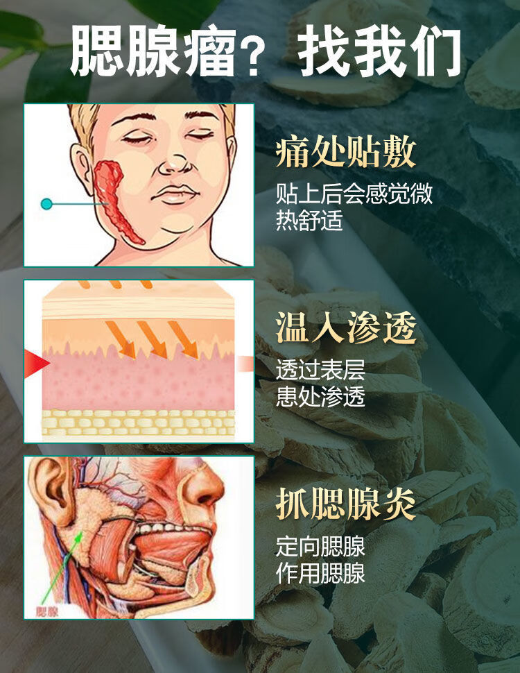 【200%断垠】腮腺混合瘤腮腺肿大耳朵下凸起肿块硬块囊肿消瘤贴 【三