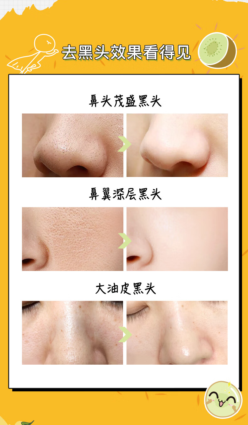 【精选优货】英尚去黑头小绿膜套装收缩毛孔女学生专用清洁鼻贴 40g