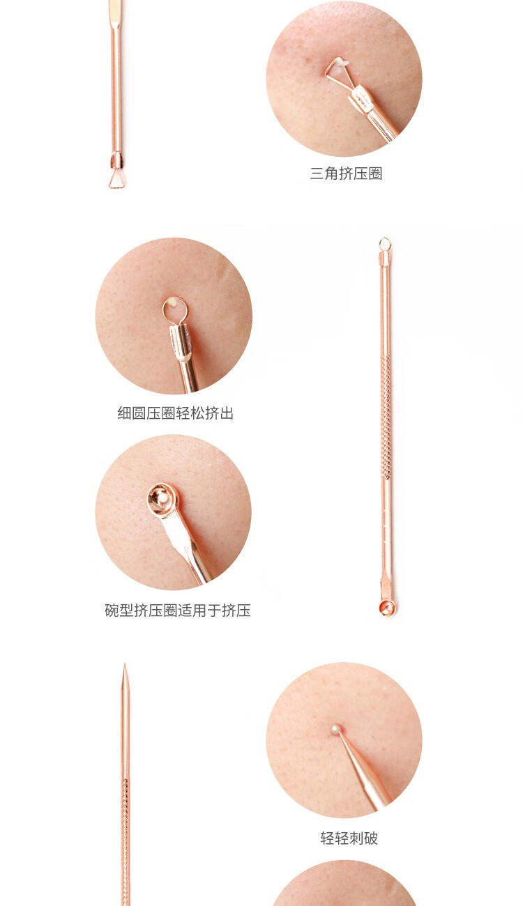阿嚓热（ACARE） 不锈钢粉刺针挤痘痘排针三角头脸部美容细胞夹套装带多功能工具 1号双圈挤压棒+收纳盒