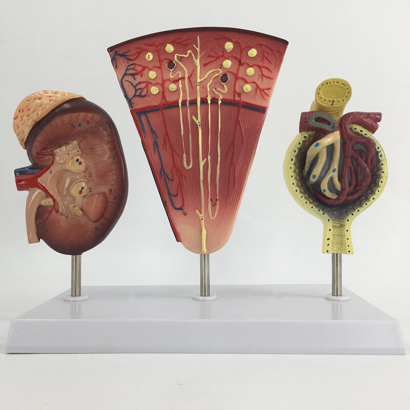 汁寒磐 肾小球模型泌尿解剖结构人体肾模型肾脏模型肾与肾单位 立体肾