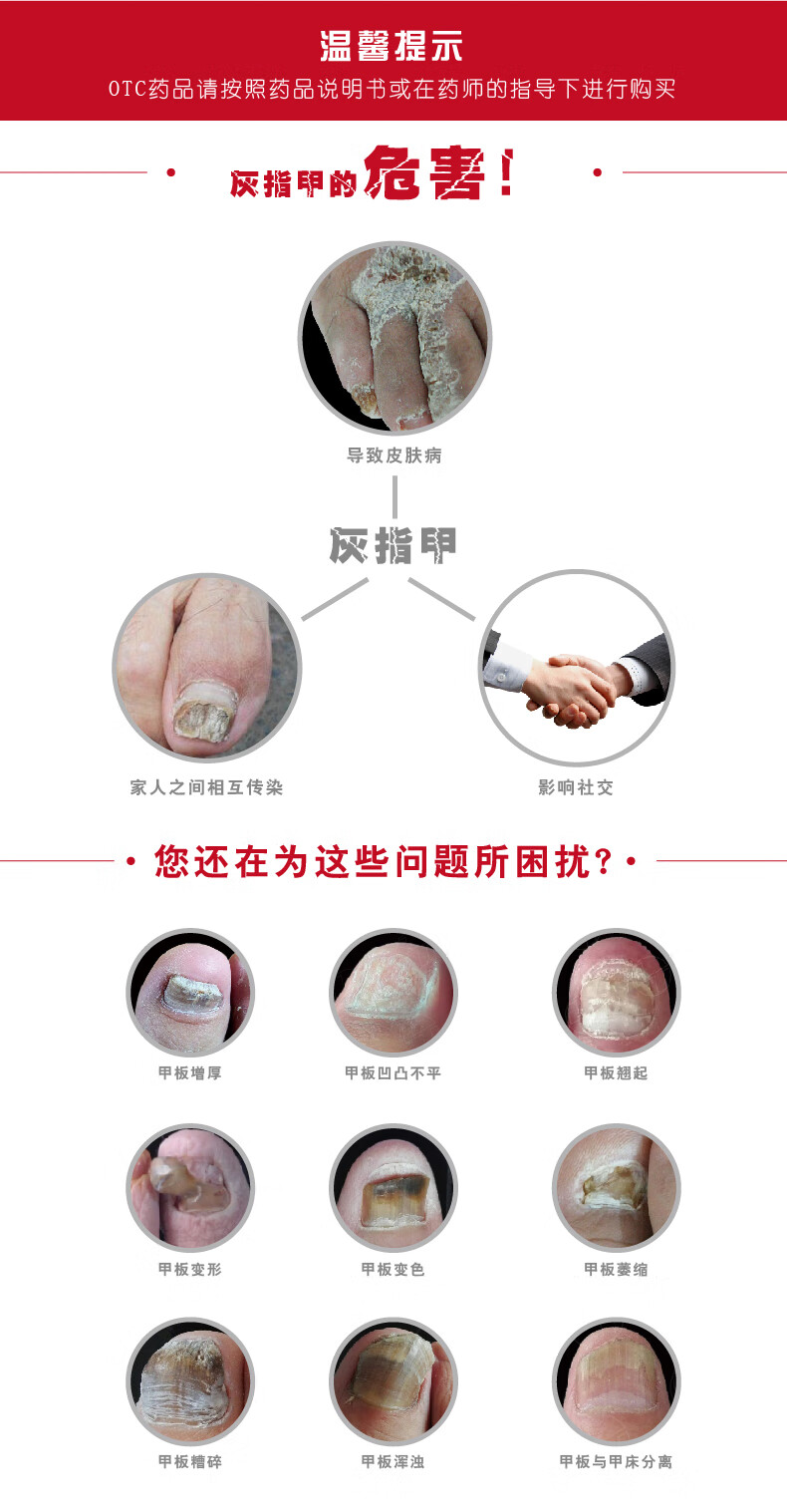 乐泰亮甲复方聚维酮碘搽剂灰指甲专用药去甲癣水原哈尔滨快好亮甲标准