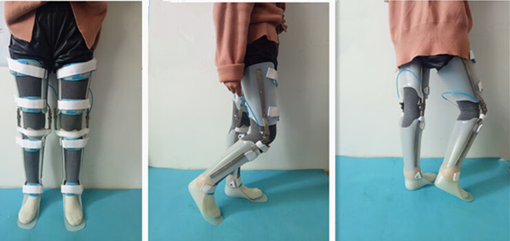 素界器械店定制矫形器拉线锁膝踝足矫形器偏瘫儿麻截瘫训练行走支具