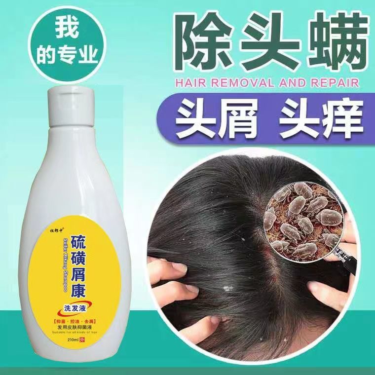 剪发虫洗发水儿童专用硫磺皂洗头液控油去屑止痒除螨虱虫洗护发膏一瓶